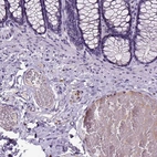 Immunohistochemical staining of human colon shows moderate cytoplasmic positivity in peripheral ganglion.