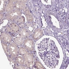 Immunohistochemical staining of human kidney shows very weak positivity in cells in tubules as expected.