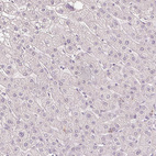 Immunohistochemical staining of human liver shows no positivity in hepatocytes as expected.