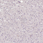 Anti-SCGN Antibody