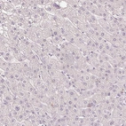 Immunohistochemical staining of human liver shows no positivity in hepatocytes as expected.