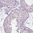 Immunohistochemical staining of human testis shows no positivity in cells in seminiferous ducts as expected.