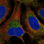 Immunofluorescent staining of human cell line U-2 OS shows localization to endoplasmic reticulum & vesicles.