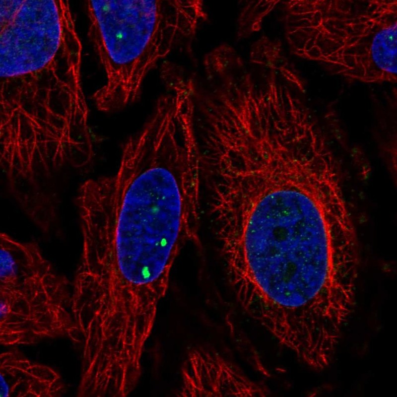 Anti-PLXDC2 Antibody
