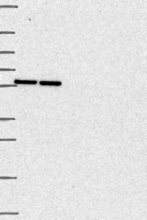 Anti-TMPO Antibody