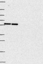 Anti-TMPO Antibody