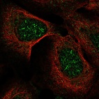 Anti-IP6K2 Antibody