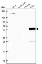 Western blot analysis in human cell line RT-4, human cell line U-251 MG, human plasma and human liver tissue.