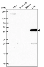 Western blot analysis in human cell line RT-4, human cell line U-251 MG, human plasma and human liver tissue.