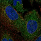 Anti-ESYT2 Antibody