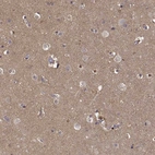 Immunohistochemical staining of human cerebral cortex shows high expression.