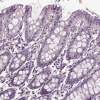 Immunohistochemical staining of human colon shows low expression as expected.