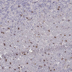 Immunohistochemical staining of human cerebellum shows strong membranous positivity in neuronal cells in granular layer.