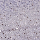 Immunohistochemical staining of human cerebellum shows strong membranous positivity in neuronal cells in granular layer.