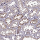 Immunohistochemical staining of human kidney shows moderate membranous positivity in cells in tubules.