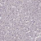 Immunohistochemical staining of human liver shows no membranous positivity in hepatocytes as expected.