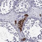 Immunohistochemical staining of human testis shows strong cytoplasmic granular positivity in Leydig cells.