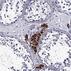 Immunohistochemical staining of human testis shows strong cytoplasmic granular positivity in Leydig cells.
