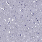 Immunohistochemical staining of human cerebral cortex shows no positivity in neurons as expected.