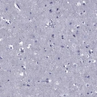 Immunohistochemical staining of human cerebral cortex shows no positivity in neurons as expected.