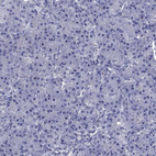 Immunohistochemical staining of human pancreas shows no positivity in exocrine glandular cells as expected.