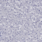 Anti-MGARP Antibody