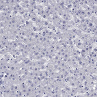 Immunohistochemical staining of human liver shows no positivity in hepatocytes as expected.