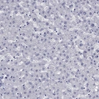 Immunohistochemical staining of human liver shows no positivity in hepatocytes as expected.