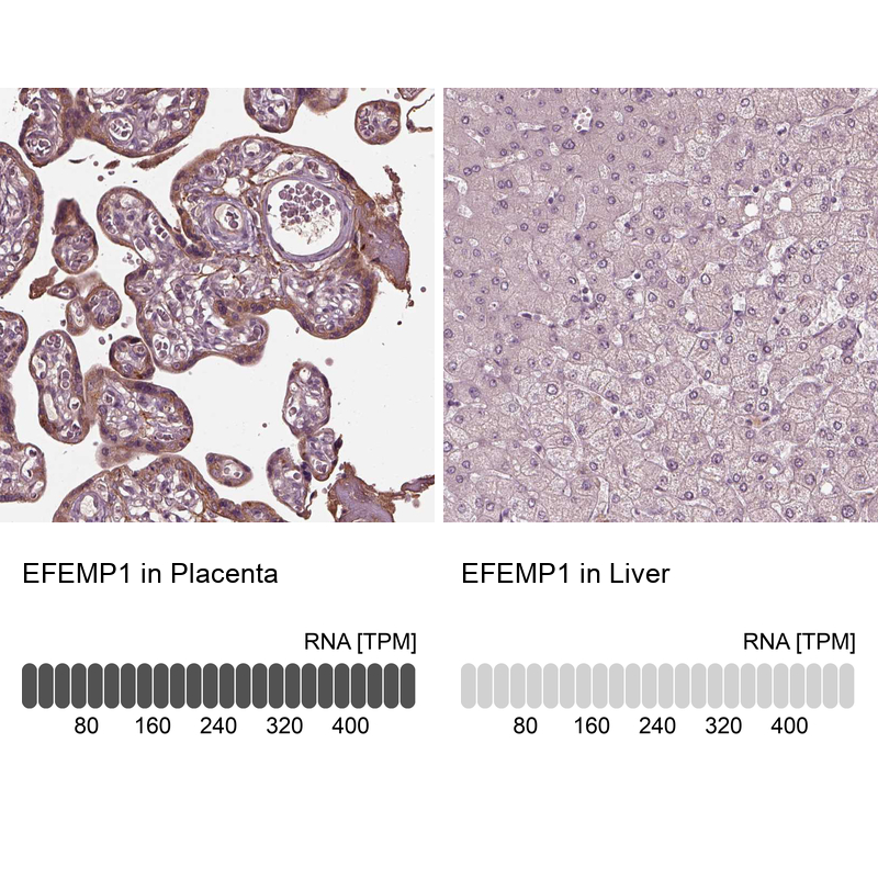 Anti-EFEMP1 Antibody