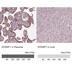 Anti-EFEMP1 Antibody