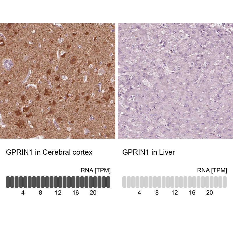 Anti-GPRIN1 Antibody