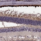 Immunohistochemical staining of human eye, retina shows moderate to strong cytoplasmic positivity.