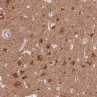 Immunohistochemical staining of human cerebral cortex shows strong cytoplasmic positivity in neurons.