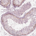 Immunohistochemical staining of human testis shows strong membranous positivity in spermatogonia.