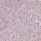 Immunohistochemical staining of human liver shows low positivity in hepatocytes.