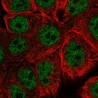 Anti-WASHC5 Antibody