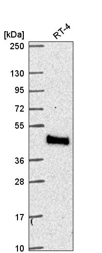 Anti-MTMR9 Antibody