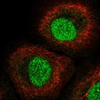 Anti-IRF1 Antibody