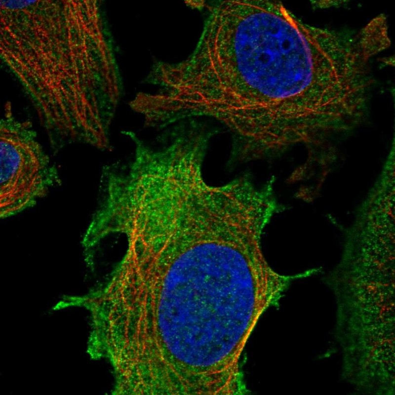 Anti-ULBP1 Antibody