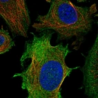 Anti-ULBP1 Antibody