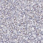 Anti-TOR1AIP1 Antibody