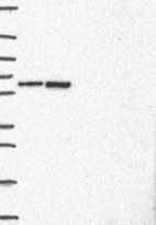 Lane 1: Marker [kDa] 250, 130, 95, 72, 55, 36, 28, 17, 10 | Lane 2: RT4 | Lane 3: U-251 MG | Lane 4: Human Plasma | Lane 5: Liver | Lane 6: Tonsil