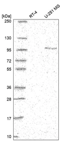 Western blot analysis in human cell line RT-4 and human cell line U-251 MG.