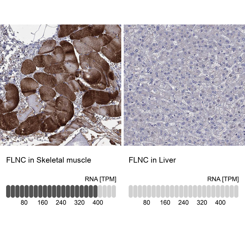 Anti-FLNC Antibody