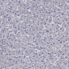 Anti-FLNC Antibody