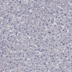 Immunohistochemical staining of human liver shows low expression as expected.