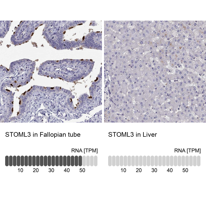 Anti-STOML3 Antibody