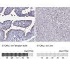 Anti-STOML3 Antibody