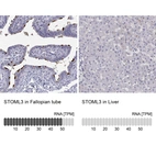 Anti-STOML3 Antibody