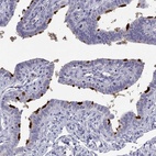 Immunohistochemical staining of human fallopian tube shows high expression.